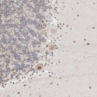Anti-AUTS2 antibody produced in rabbit 