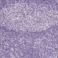 Anti-AWAT2 antibody produced in rabbit 