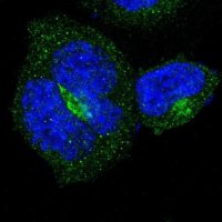 Anti-B4GALT3 antibody produced in rabbit 