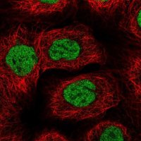 Anti-BACH1 antibody produced in rabbit 