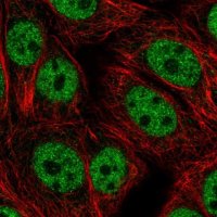 Anti-BANP antibody produced in rabbit 