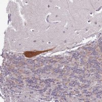 Anti-BCAR1 antibody produced in rabbit 