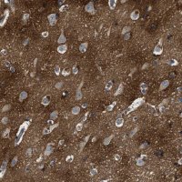 Anti-BLOC1S1 antibody produced in rabbit 