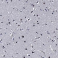 Anti-BRD1 antibody produced in rabbit 