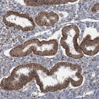 Anti-BRWD1 antibody produced in rabbit HPA030945-100UL