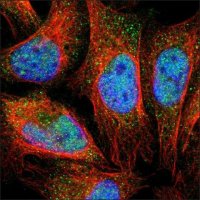 Anti-BTG1 antibody produced in rabbit HPA005972-100UL