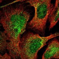 Anti-C10orf10 antibody produced in rabbit 