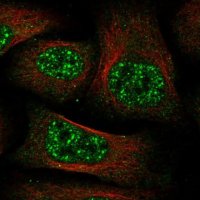 Anti-C11orf49 antibody produced in rabbit 