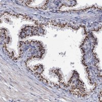 Anti-C11orf96 antibody produced in rabbit 