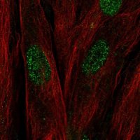 Anti-C17orf107 antibody produced in rabbit 