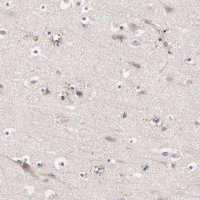 Anti-C17orf75 antibody produced in rabbit 