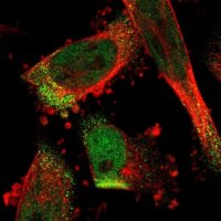 Anti-C17orf80 antibody produced in rabbit HPA012896-100UL