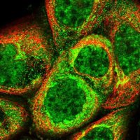 Anti-C19orf24 antibody produced in rabbit 