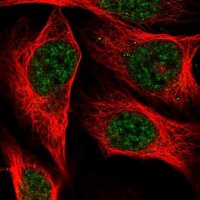 Anti-C19orf47 antibody produced in rabbit 
