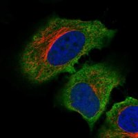 Anti-C19ORF71 antibody produced in rabbit HPA048654-100UL