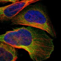Anti-C1orf198 antibody produced in rabbit 