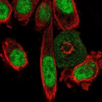 Anti-C2orf82 antibody produced in rabbit 
