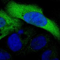 Anti-C3orf18 antibody produced in rabbit 