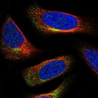 Anti-C3orf70 antibody produced in rabbit 