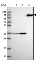 Anti-C6 antibody produced in rabbit 