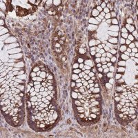 Anti-C6ORF203 antibody produced in rabbit 