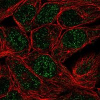 Anti-CA12 antibody produced in rabbit 