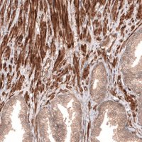 Anti-CACNA1H antibody produced in rabbit 