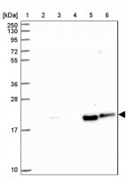 Anti-CARHSP1 antibody produced in rabbit HPA051911-100UL