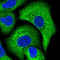 Anti-CAST antibody produced in rabbit 