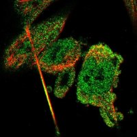 Anti-CBR3 antibody produced in rabbit 