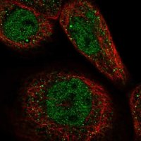 Anti-CCDC113 antibody produced in rabbit HPA040759-100UL