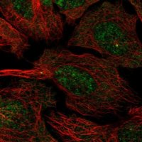 Anti-CCDC13 antibody produced in rabbit 