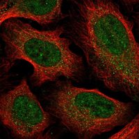 Anti-CCDC18 antibody produced in rabbit 