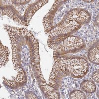 Anti-CCDC30 antibody produced in rabbit 