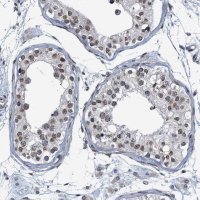Anti-CCDC34 antibody produced in rabbit 