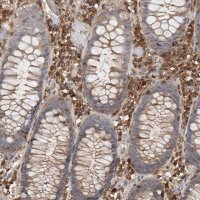Anti-CCDC88B antibody produced in rabbit 