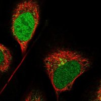 Anti-CCDC91 antibody produced in rabbit 