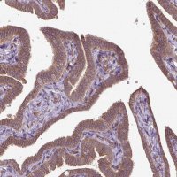 Anti-CCDC93 antibody produced in rabbit 