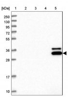 Anti-CCRL2 antibody produced in rabbit 
