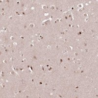 Anti-CCSER2 antibody produced in rabbit 