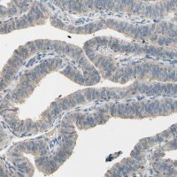 Anti-CDH6 antibody produced in rabbit 