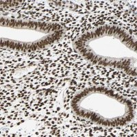 ANTI-CDK12 antibody produced in rabbit 