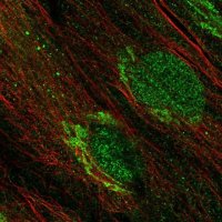 ANTI-CDK15 antibody produced in rabbit 