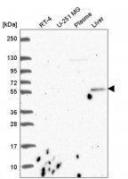 Anti-CDK5RAP1 antibody produced in rabbit 