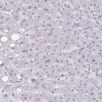 Anti-CEACAM18 antibody produced in rabbit HPA059487-100UL