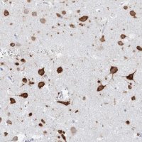Anti-CELF4 antibody produced in rabbit 