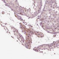 Anti-CELSR3 antibody produced in rabbit 