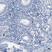 Anti-CER1 antibody produced in rabbit HPA019917-100UL