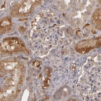 Anti-CFB antibody produced in rabbit 