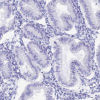 Anti-CGB3 antibody produced in rabbit 